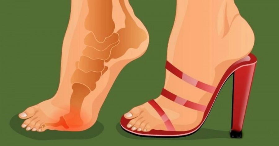 Ez a trükk segít, hogy többé ne fájduljon meg a lábad, ha magassarkú cipő van rajtad!